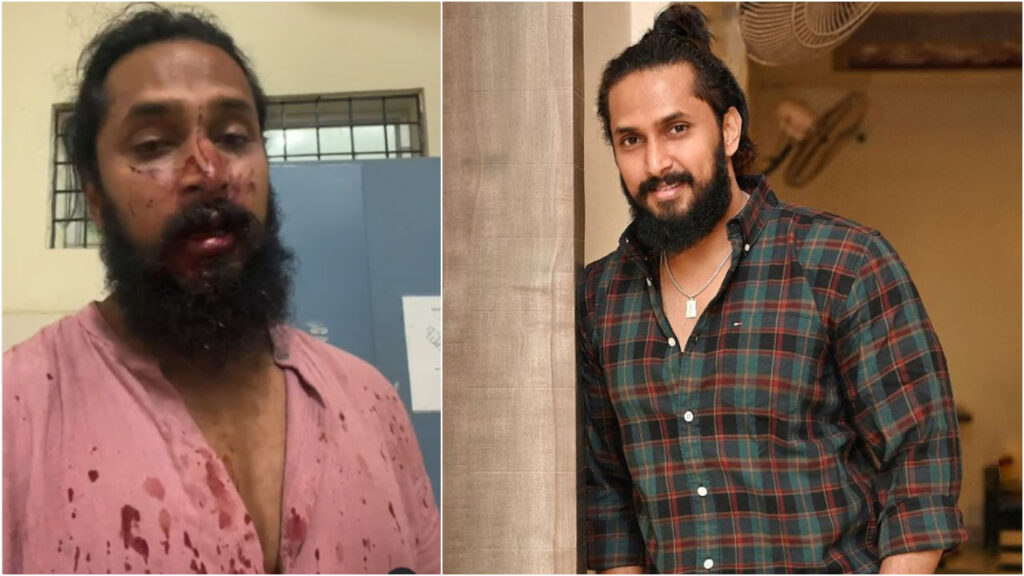 chetan-chandra
